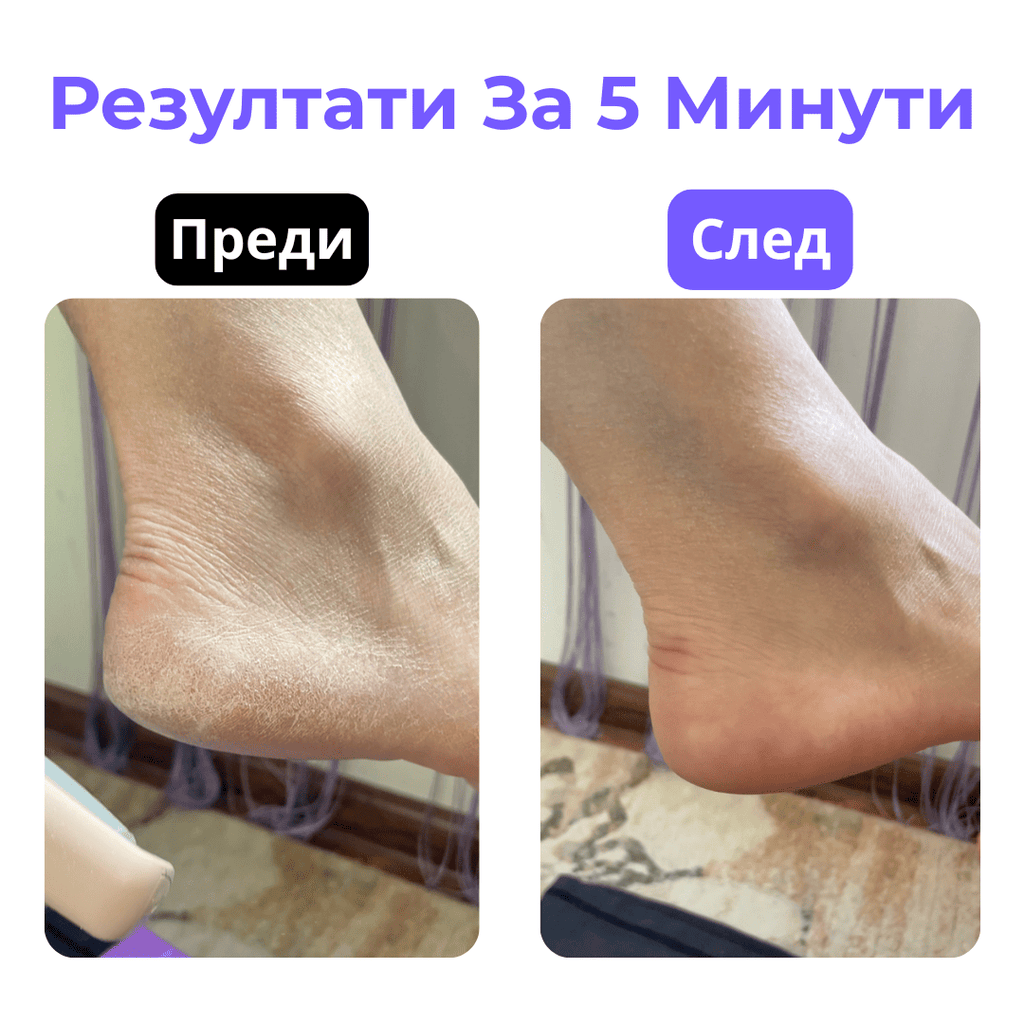 Footé Smooth